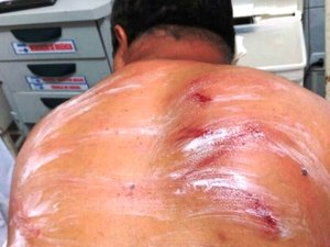 Radialista alagoano é agredido por  homens armados na porta de casa em Pernambuco