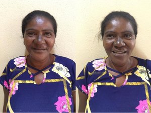 Pacientes recebem próteses dentárias em Lagoa da Canoa