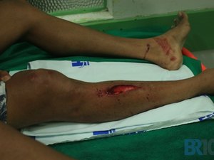 Motociclista se distrai e colide contra poste em União dos Palmares