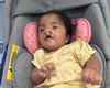 Família faz rifa para custear cirurgias de bebê nascida com malformações