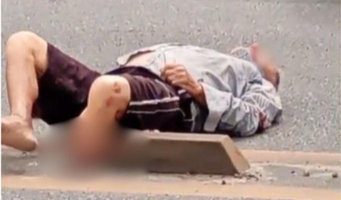 Homem é atropelado por moto e sofre fratura exposta na Av. Menino Marcelo