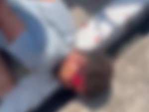 Suspeito sofre traumatismo craniano após ser espancado por populares em Arapiraca