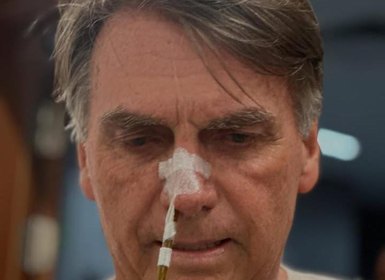 Bolsonaro tem dreno retirado, não tem febre e segue com boa evolução clínica, diz boletim