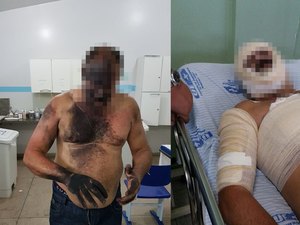 Aparelho celular explode enquanto policial conversa ao telefone