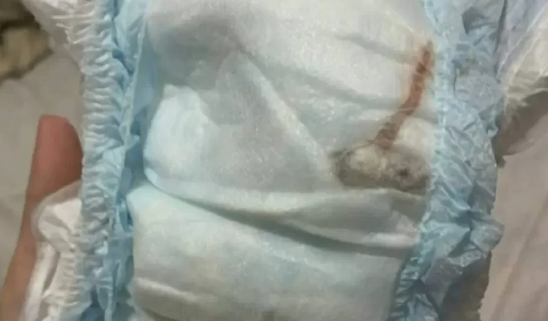 Mãe encontra rato morto dentro da fralda de bebê de um mês no Rio de Janeiro