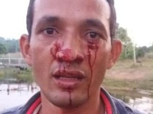Homem é atacado durante pescaria por sucuri de 3 metros que o atinge no rosto
