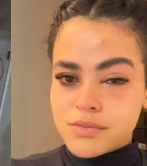 'Mosquinha parece ser inofensiva, mas não é', diz jovem que viralizou após infecção ocular