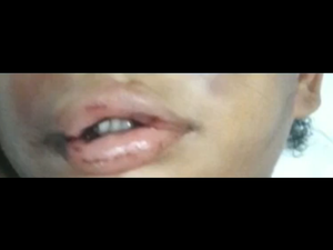 Criança de quatro anos é internada na UTI após suposto espancamento