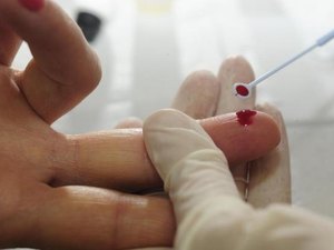 Alerta: Casos de sífilis voltam a aumentar no Brasil