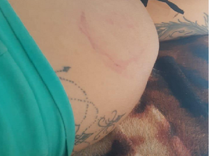 Grávida denuncia companheiro por homicídio e é agredida a tijoladas em Maceió