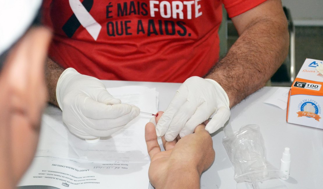 Hospital Helvio Auto oferece testes de HIV abertos ao público nesta sexta-feira (6)