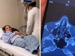 Juliette Freire fratura o nariz em acidente doméstico: 'Está meio torto'