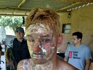 Grávida de 4 meses é estuprada e queima rosto de ex