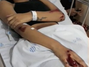 Jovem é arrastada por veículo após ser atropelada no Graciliano Ramos