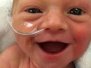 Internautas se encantam com sorriso de bebê prematuro