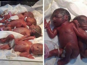 Mulher dá à luz sétuplos de forma natural e faz história no Iraque 