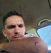 Pedreiro sofre acidente em SC ao fugir de confusão e precisa de doações para voltar para AL