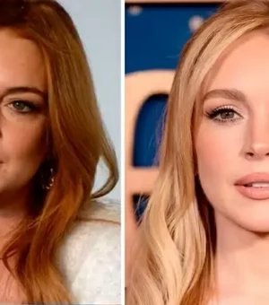 Lindsay Lohan gastou R$ 1,7 milhão para rejuvenescer, diz especialista