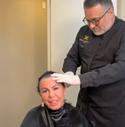 Gretchen raspa cabeça em live antes de iniciar transplante capilar