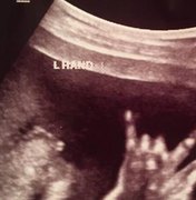 Feto faz suposto sinal de 'mão-chifrada' em ultrassom e pais ficam orgulhosos