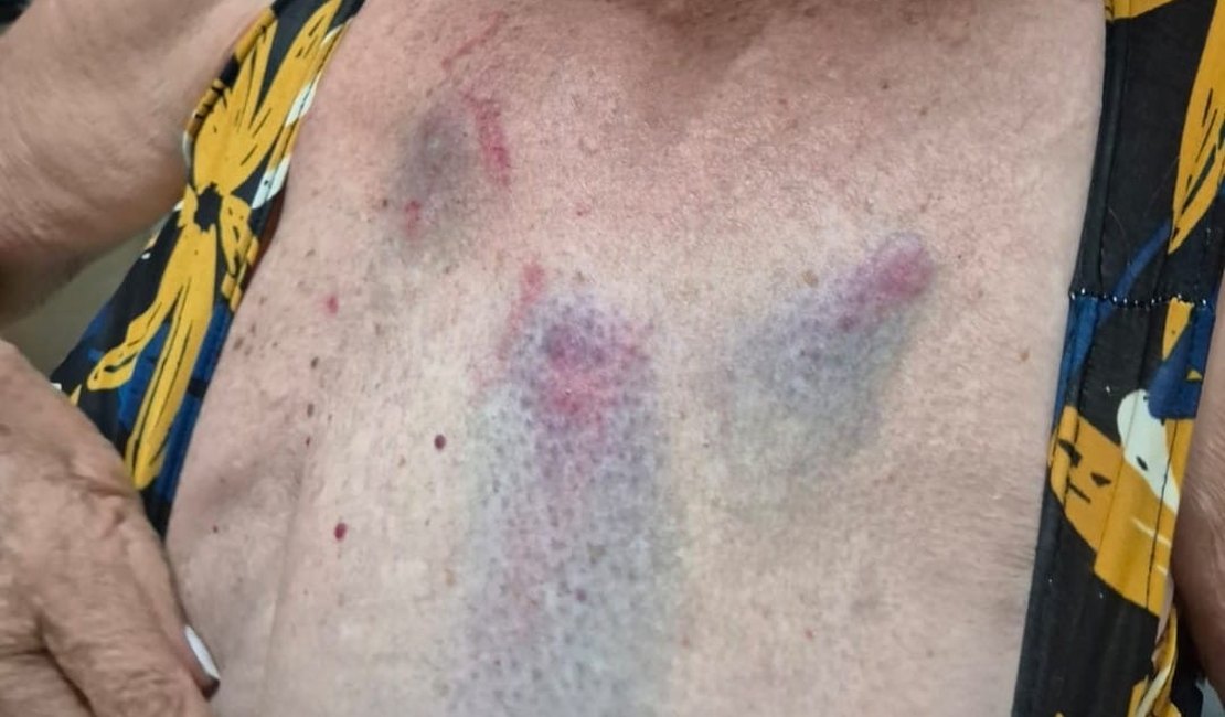 Médica que agrediu tia idosa de 77 anos é presa pela segunda vez em Arapiraca