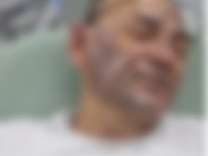 Sargento sofre queimadura ao ser atingido por óleo quente durante ocorrência com paciente psiquiátrico