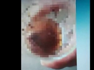 Mulher admite que arrancou testículo de homem com mordida: 'Ponto fraco'