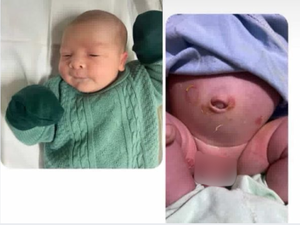 Mãe denuncia que recém-nascido contraiu bactéria após alta do Hospital Regional de Arapiraca