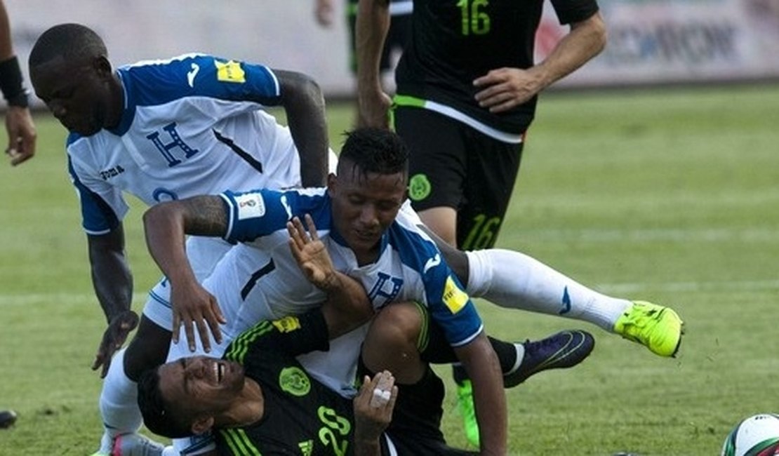 [Vídeo] Jogador de Honduras sofre fratura exposta em jogo