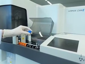 Exame de sangue para Alzheimer chega ao Brasil; veja quanto custa