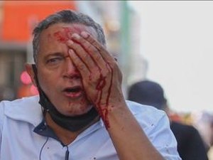 Governo de Pernambuco vai indenizar feridos pela PM durante manifestação