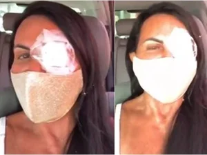 Gretchen passa por cirurgia de emergência nos olhos: “Muito delicada”