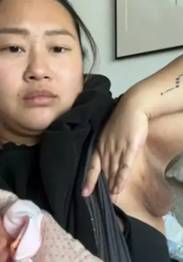 Mulher viraliza ao relatar terceiro seio durante amamentação