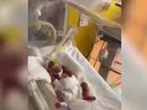 Mulher do Mali que achava que teria sétuplos dá à luz nove bebês