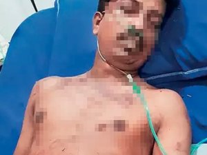 Mulher arranca pênis de vizinho que a assediava sexualmente