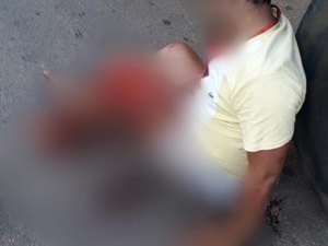 Motociclista fica ferido após colidir com caminhão pipa em Palmeira dos Índios