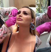 Andressa Urach faz botox com o marido: 'Ficar mais lindo para mim'