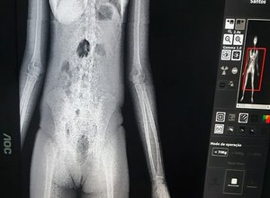 Mulher é presa ao tentar entrar em presídio com drogas nas partes íntimas 