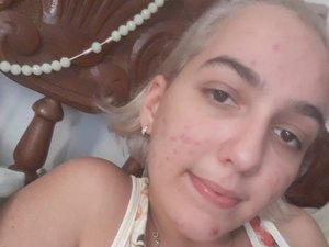 Há dois meses jovem aguarda a prefeitura de Arapiraca para retirar um tumor cerebral