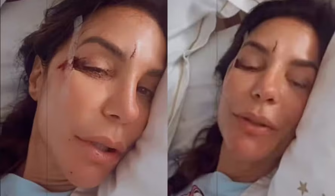 Ivete Sangalo surge em hospital com machucados no rosto e relata susto: 'Desmaiei'
