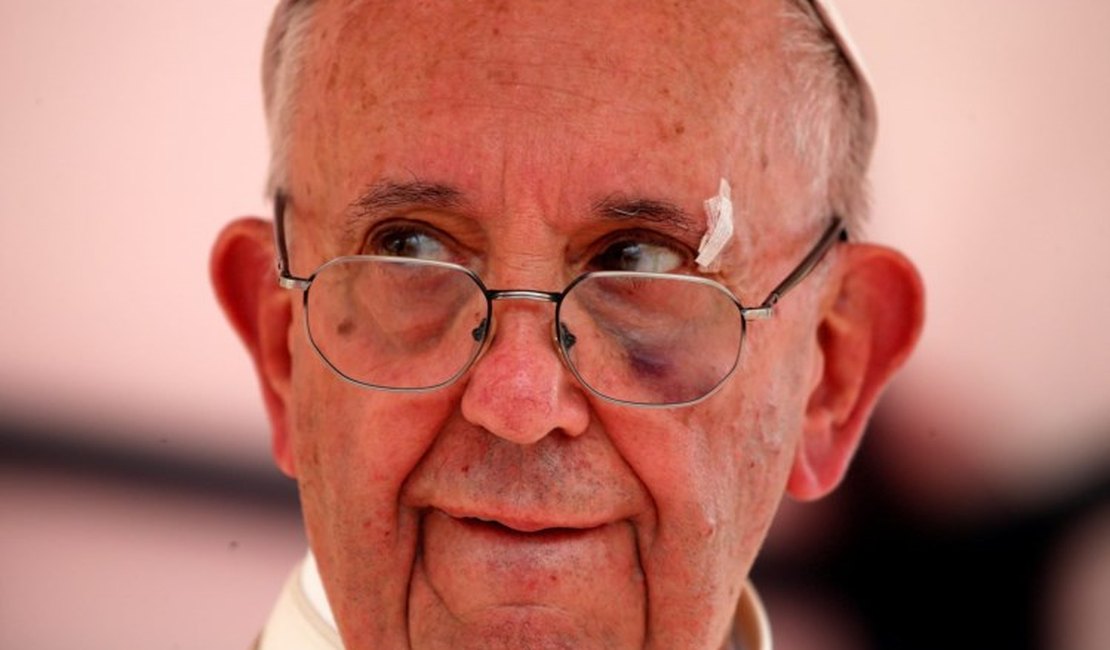 Papa Francisco se machuca sem gravidade no papamóvel