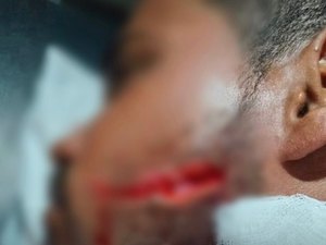 Jovem é atingido por facada no rosto durante vaquejada em Delmiro Gouveia