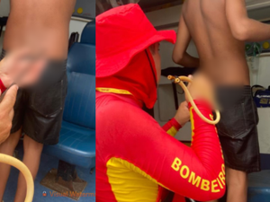 Adolescente de 14 anos é atingido por arpão durante pesca na praia do Francês