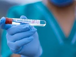 Alagoas chega a marca de 903 óbitos por Covid-19