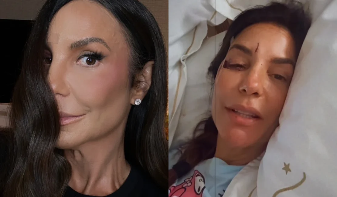 Ivete Sangalo retoma treinos após acidente doméstico e cirurgia