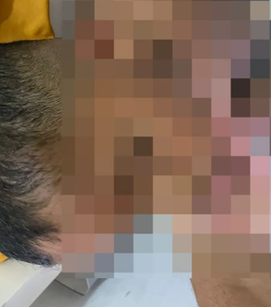 Família denuncia babá por agressões a criança autista de 5 anos em Arapiraca