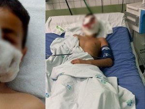 Criança de 10 anos tem orelha decepada ao ser atacada por pitbull