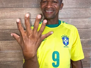 Baiano com seis dedos pretende comemorar hexa da seleção com uma mão só: 'fico ansioso'