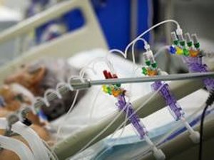 Coronavírus: quando o respirador mecânico é usado no tratamento