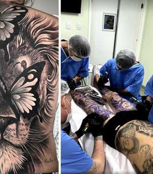 Conselho Federal de Medicina proíbe uso de anestesia para tatuagens estéticas